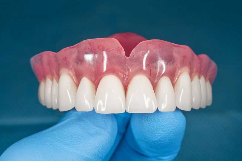 18. DENTURE.jpg